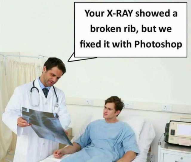 your-x-ray-showed-a-broken-rib-but-we-fixed-it-with-photoshop.jpg